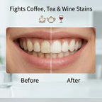 Purple Teeth Whitening Strips | 70% OFF🔥 Last Day Sale