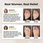 The 3-Second Non-Surgical Bunion Fix: Ultra-Thin & Invisible-Last Day Sale! 🔥70% OFF